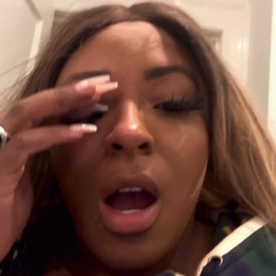 Celebration Turns Painful After Woman Uses Nail Glue Instead of Eye Drops